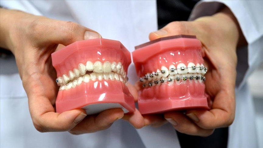 Ortodonti Uzmanı Seçerken Nelere Dikkat Edilmeli?